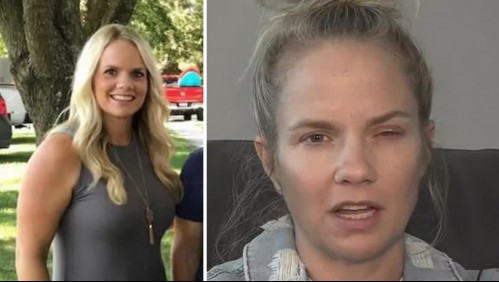 Infecta más a quienes usan lentes de contacto: Este es el parásito que podría dejar ciega a una mujer estadounidense