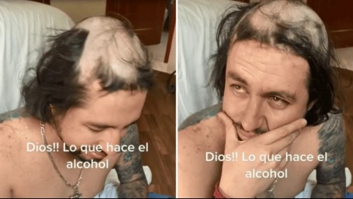 Padre llegó borracho a su casa, se quedó dormido y sus hijos le cortaron el pelo