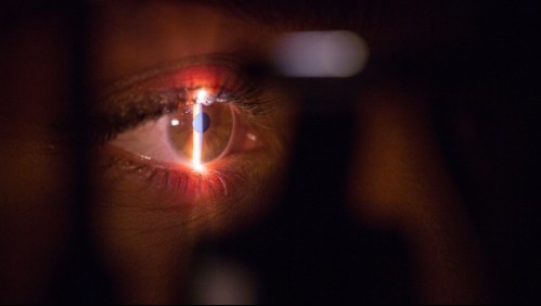 Podría producir glaucoma: Así es cómo se puede detectar si es que tienes alta la presión ocular