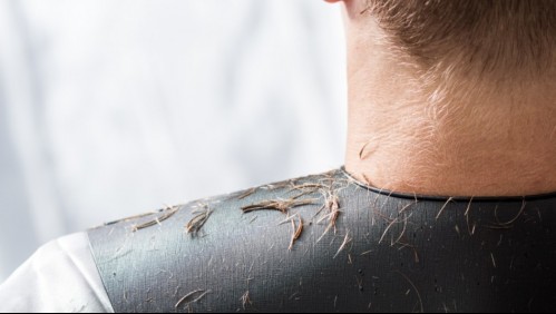 'No le gustó el corte que le hizo': Hombre le propinó una golpiza a un peluquero y lo amenazó de muerte