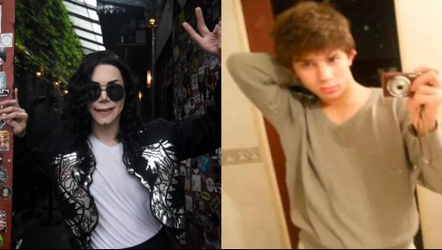 La impactante transformación de joven que se sometió a 13 cirugías para parecerse a Michael Jackson
