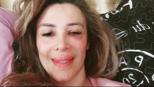 'La situación es grave': Romina Sáez se encuentra hospitalizada tras sufrir violenta golpiza meses atrás