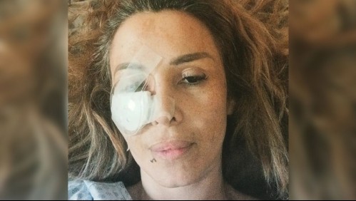 Intervendrán directamente su rostro: Romina Sáez será operada por tercera vez tras haber sufrido una golpiza