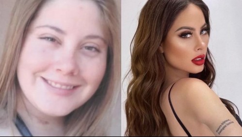 'No me gusta esconder lo que fui': Ignacia Michelson reacciona a su 'antes y después' y revela todas sus cirugías