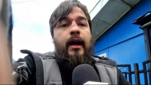 Reportero es agredido en vivo: Le fracturaron la nariz y acusa a funcionario público de haberlo atacado