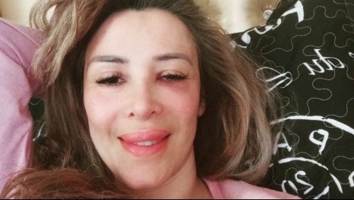 'Estuve a punto de tirar la toalla': Romina Sáez tras tercera operación en el rostro luego de sufrir fuerte golpiza