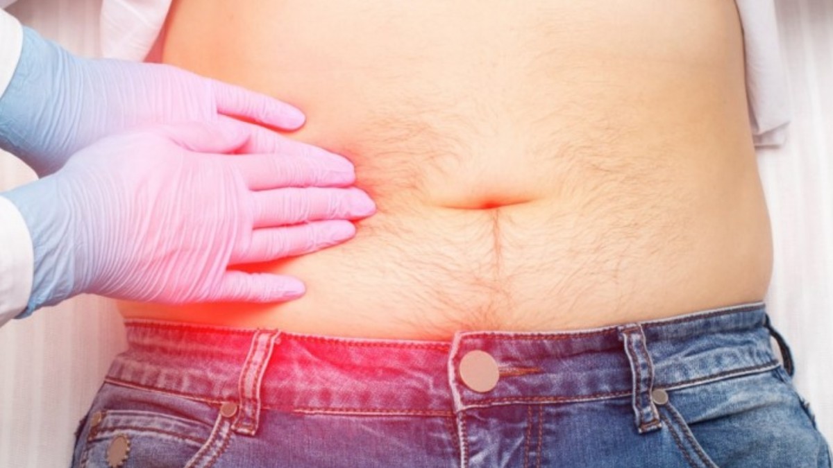 fácil de lastimarse Cosquillas Ficticio Cálculos en la vesícula: Los 5 síntomas que advierten que puedes tener piedras en el órgano - Meganoticias fácil de lastimarse Cosquillas Ficticio Cálculos en la vesícula: Los 5 síntomas que advierten que puedes tener piedras en el órgano - Meganoticias