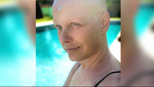 'Sentí miedo': Estas son las complicaciones médicas que ha tenido Claudia Conserva durante su tratamiento por cáncer
