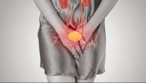 ¿Te arde al orinar? Estas son 7 señales que advierten que tienes una infección urinaria