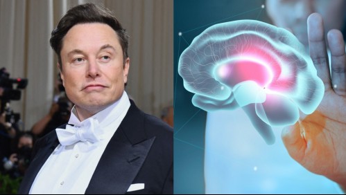 Esperan probarlo en humanos en 2023: Compañía de Elon Musk será la primera en implantar chips cerebrales
