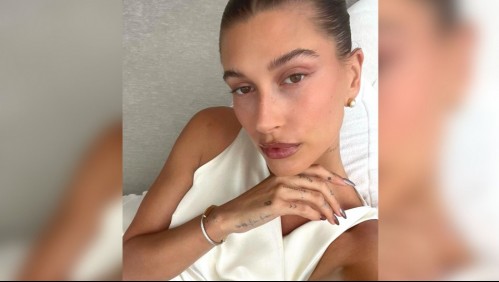 'Nunca es divertido': Hailey Bieber explica cómo se siente tener un quiste ovárico del 'tamaño de una manzana'