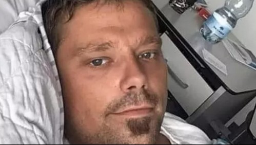 Fue mordido en la mano por su gato y murió cuatro años después por una bacteria 'come carne'