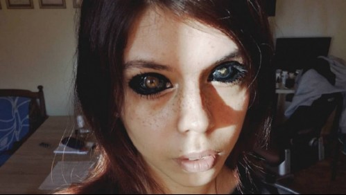 Joven modelo quería parecerse a su artista favorito, se tatuó los ojos y quedó ciega