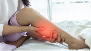 ¿Cómo saber si tienes un coágulo en la pierna? Estos son los síntomas de la trombosis venosa profunda
