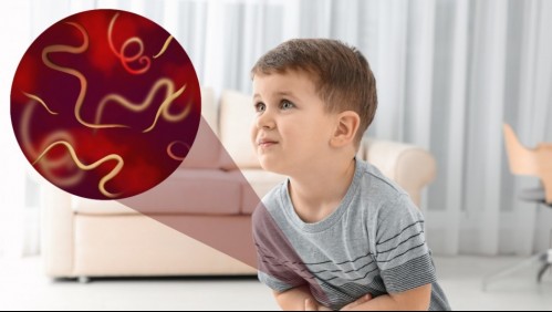 Lombriz solitaria: Estos cuatro síntomas indican que tienes el parásito