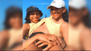 No pueden ser separadas: Este es el caso de Lupita y Carmen, las hermanas que son siamesas onfalópagos