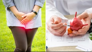 ¿Problemas en la vejiga? Estos son los síntomas que advierten que algo anda mal