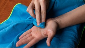 ¿Es hiperhidrosis o calor? Estas son las señales de la afección que hace sudar en exceso