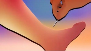 Fue al médico por un dolor en sus piernas y resultó que tenía una enfermedad mortal