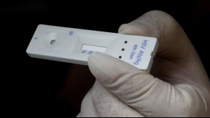 Seremi de Salud rectifica resultados de positividad de VIH en la RM: Tasa es de 1,3% y no 30% como se había reportado