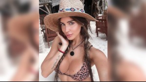 'Un desastre': Esta es la complicación que sufrió Fran Undurraga en delicada cirugía