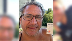 'Me caí al suelo': La complicación médica que sufrió el actor Juan Pablo Sáez tras ser picado por avispa