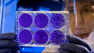 Virus de Marburgo: Estos son los síntomas de la mortal enfermedad que encendió las alarmas de la OMS