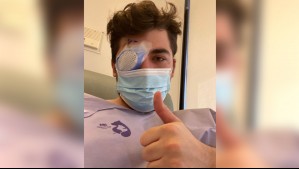 Perdió la vista del lado derecho: Este es el parásito que se comió parte del ojo de un joven