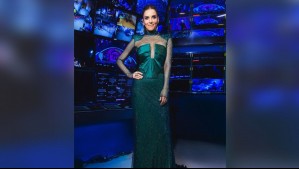 Carboxiterapia: El tratamiento que usó María Luisa Godoy para perder grasa después de su embarazo