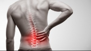 ¿Dolor a la espalda o problemas en los riñones? Así puedes diferenciarlos