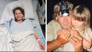 10 años de dolor 'insuperable': Esta es la complicada enfermedad que sufre la hija del 'cazador de cocodrilos'
