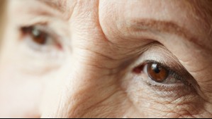 Cataratas: Estos son los síntomas que advierten sobre la pérdida de la visión
