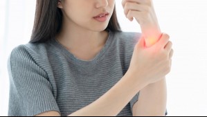 Sarna en Chile: Estos son los principales síntomas de la enfermedad