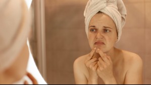 Qué es el 'triángulo de la muerte' del rostro y por qué jamás deberías reventar las espinillas que te salgan allí