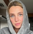 Conoce cuál es la extraña enfermedad que padece la periodista y animadora de televisión chilena, Emilia Daiber. Esta es una rara condición asociada a un gen en el cuerpo de la joven.