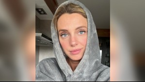 'Quedé hospitalizada a punto de morir': Esta es la extraña enfermedad que confesó tener Emilia Daiber