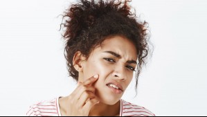 Pueden enfermarte: Estos son los parásitos que infestan el rostro y que se reproducen mientras duermes