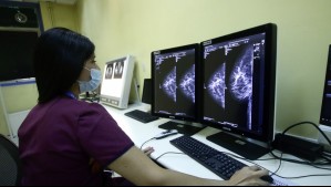 'Apunta a disminuir barreras': Ley permite que mujeres se realicen mamografías preventivas sin orden médica
