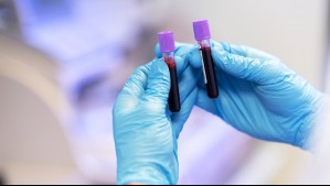 Podría ser fatal: Esto es lo que pasa con tu cuerpo si recibes el grupo de sangre equivocado