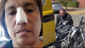 Conductora de furgón escolar agredida por motociclista: 'No era una persona en un mal día, era un energúmeno en moto'