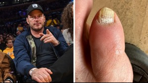 Debería ir al podólogo: Este es el problema médico que podría tener Chris Pratt en los pies, según experto