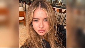 'China' Suárez se operó el rostro por una espinilla: ¿Cuándo es necesario recurrir al bisturí?