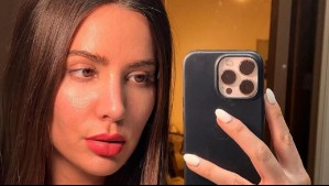 'Esto soy, no me da vergüenza': Aylén Milla sube foto sin filtro mostrando su rostro tras las quimioterapias