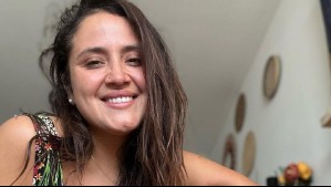 Sonriente y con nueva imagen: Así luce Pamela Leiva al aplicarse ácido hialurónico en los labios