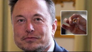 Empresa de Elon Musk comenzará ensayos con implantes cerebrales en humanos: ¿Qué significa?