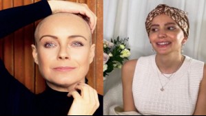 'Sea feliz': Aylén Milla envía emotivo mensaje a Claudia Conserva al anunciar regreso a la TV tras cáncer de mama
