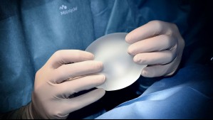 'Llevo la silicona industrial diseminada por todo mi cuerpo': Se colocó implantes defectuosos y ahora lucha por su salud