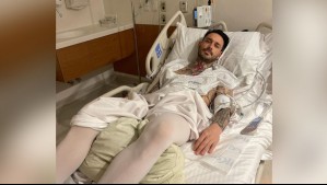 Hernia lumbar: Esta es la complicación médica por la que operaron a Mauricio Pinilla