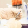 Conoce cuál es el nuevo medicamento aprobado por la Administración de Alimentos y Medicamentos (FDA) de Estados Unidos, que podría ser la primera ayuda real para los pacientes con alzhéimer.