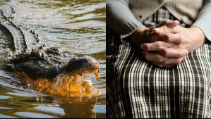 'Recuerdo meterle el dedo en el ojo': Octogenaria mujer fue atacada por un caimán, pero se salvó milagrosamente